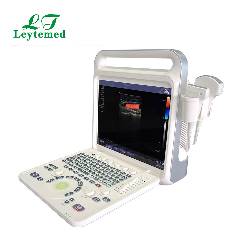 Ltub63 Urology Cardiac Gynecology Obstetric USG Color Doppler 4D Ultrasound-Machine