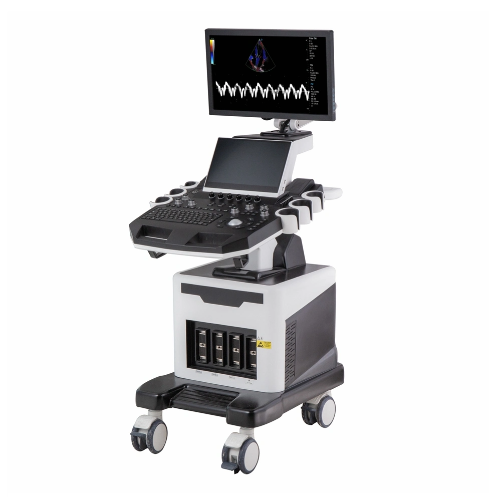 Hospital Equipment High End 4D/5D Mobile Trolley Color Doppler Ultrasound Machine for Ob&Gyn