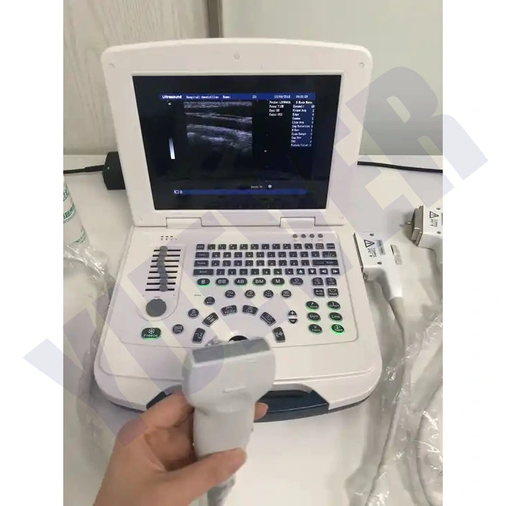 Yuever Medical Veterinary Ultrasound Scanner Equipo de pruebas de cerdo aparato de ultrasonido Para mascotas