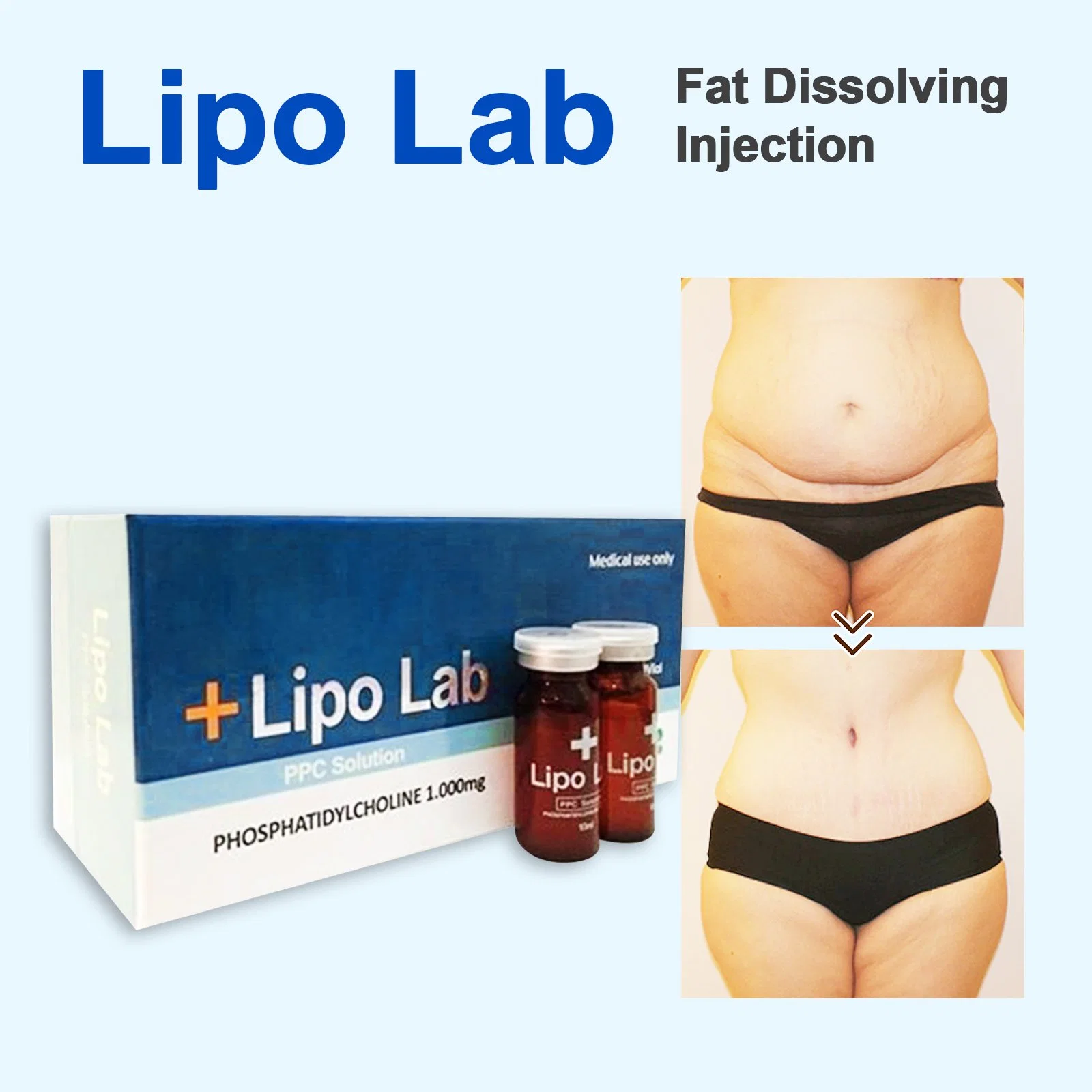 Продажа Липолиз Lipo Lipolab с возможностью горячей замены ЭБУ системы впрыска, потеря веса дополняет похудение для женщин