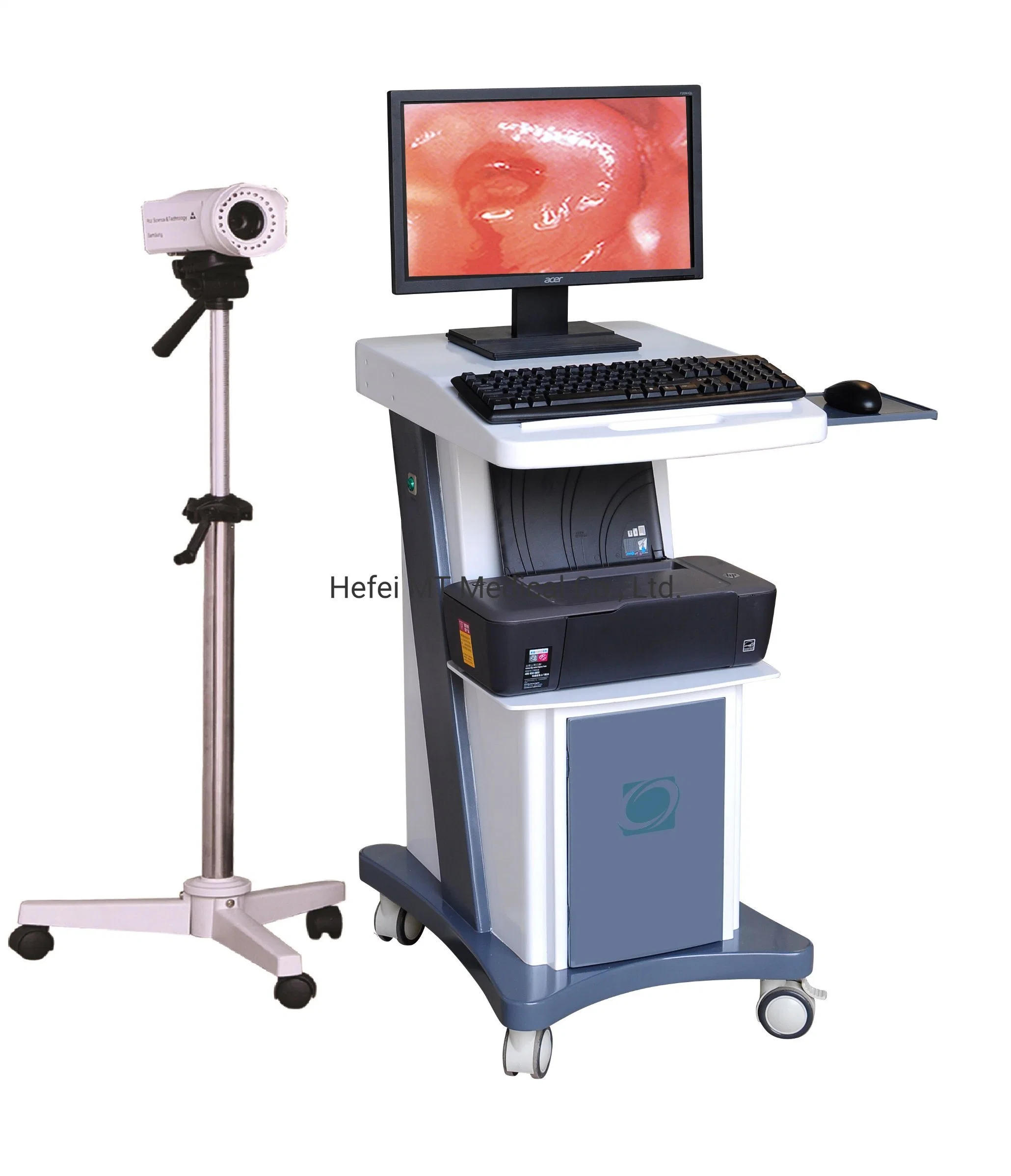 Mt Medical Cheap Digital Video Colposcope for Gynecology