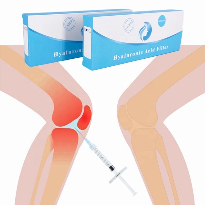 5ml acido hialuronico relleno dérmico de Ácido Hialurónico Rodilla el dolor de rodilla el tratamiento de inyecciones de relleno de inyección de la rodilla conjunta