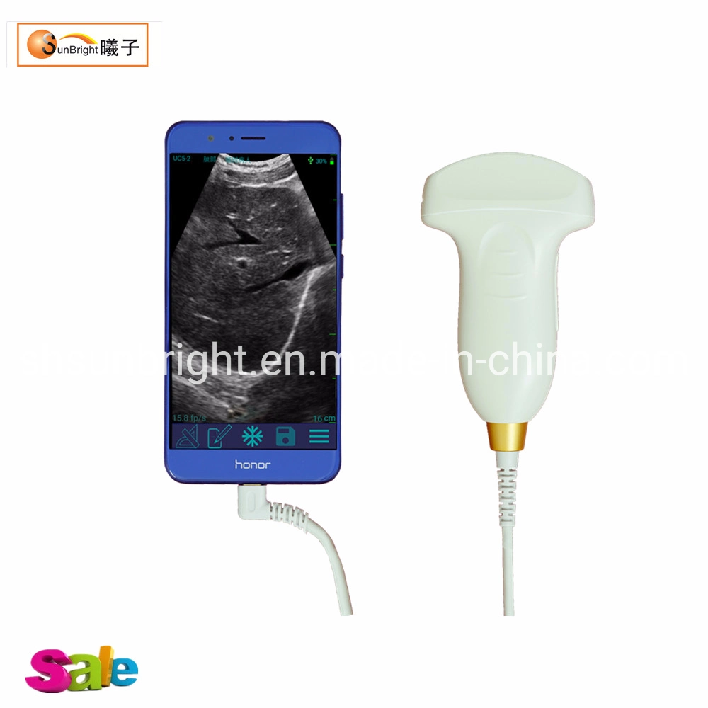 Good Quality Ob Test USB Convex Probe Sun-P1 for Smart Phone