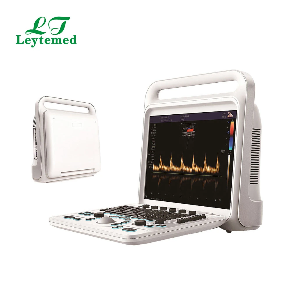 Ltub63 Urology Cardiac Gynecology Obstetric USG Color Doppler 4D Ultrasound-Machine