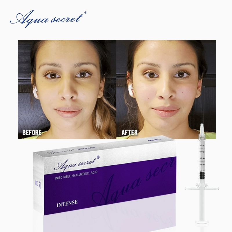 Aqua Secret Cross-Linked acide hyaluronic remplissage dermique injection pour lèvre