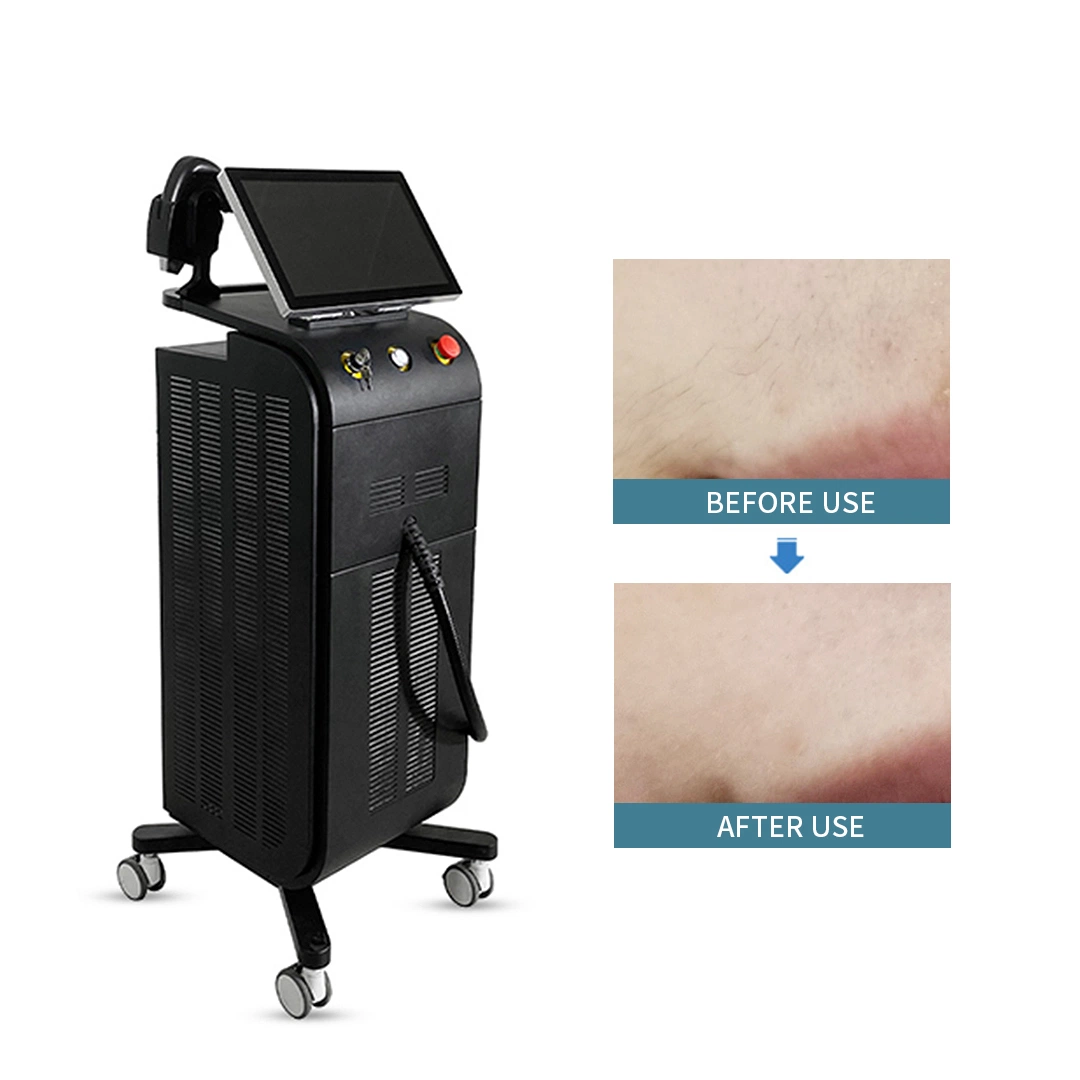 3 Wavelengths Permanent Portable 808 Nm Diode Laser Hair Removal Medical Euipmemt