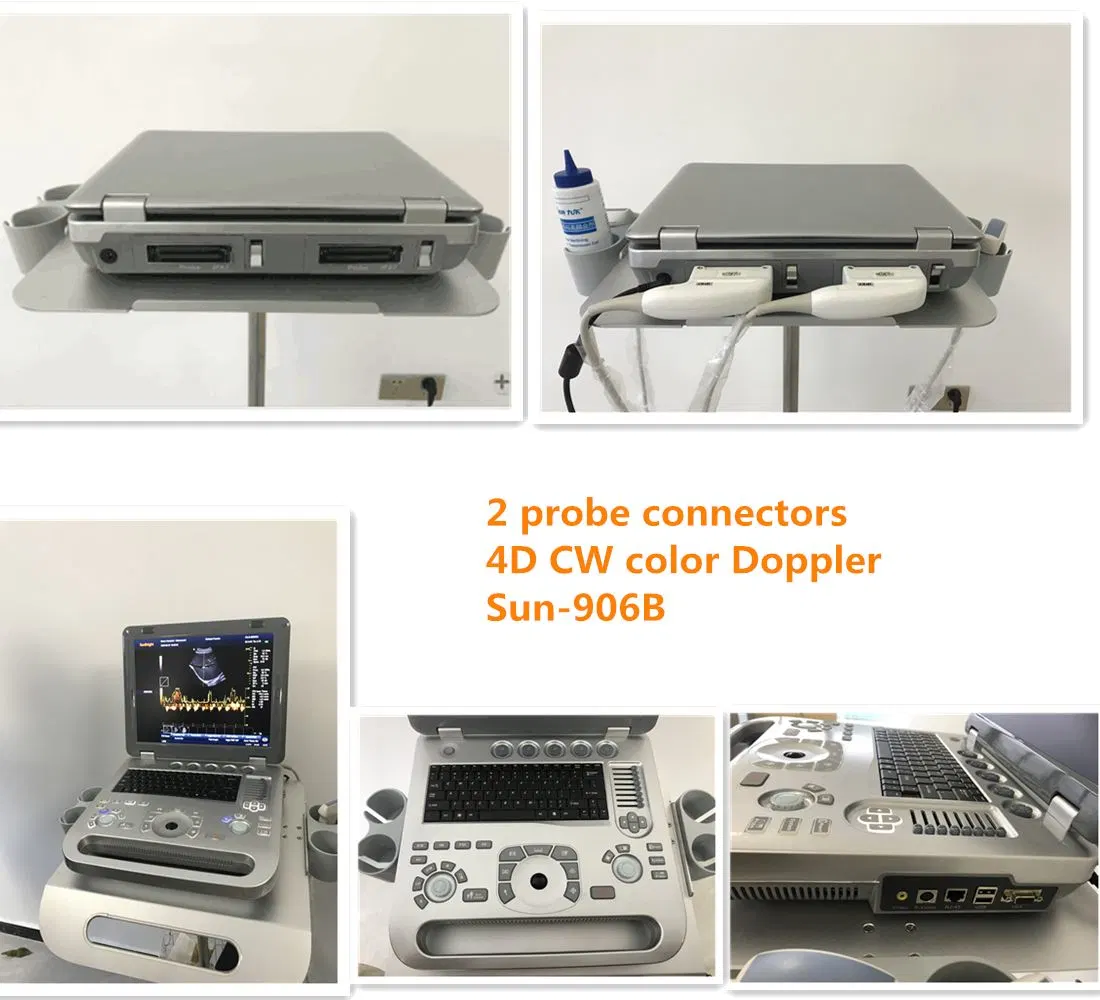 Superventas de la Originales de fábrica máquina de ultrasonido Doppler Color 4D USG