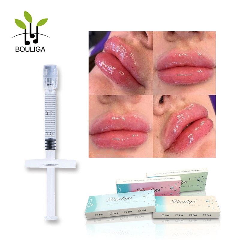 Injection Dermal Filler for Face Injection 1ml 2ml Derm for Lips Enhancement Injectable Filler