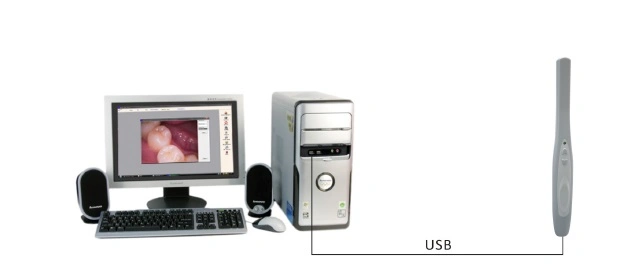 Best Selling USB Dental Oral Intra Camera with CE MD740 Dental Digital Camera Viewer