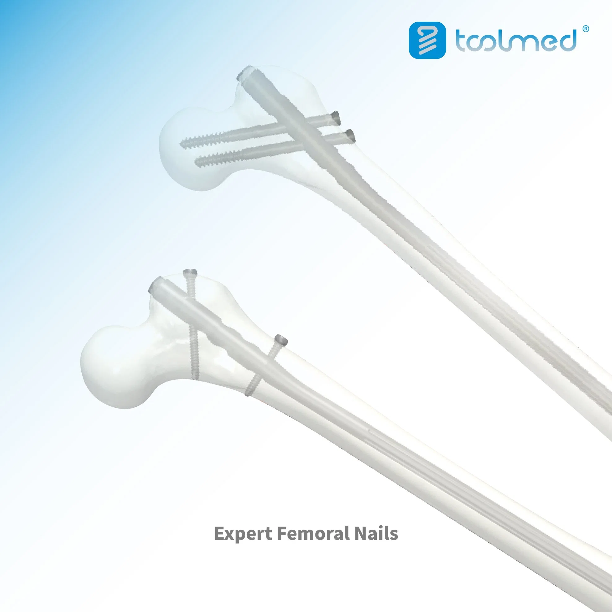 Femoral Trauma Orthopädie Implantate Experte Femoral Rekonstruktion Intramedullary Interlocking Nail Implantat für Femoralfraktur