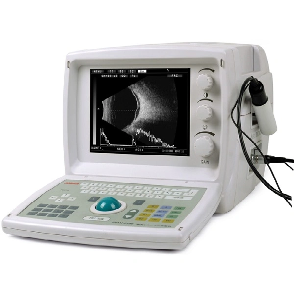 CE/ISO oftálmico médicos aprobados por Ultrasonido Ultrasonido a/b Buscar oftalmología (MT03081002)