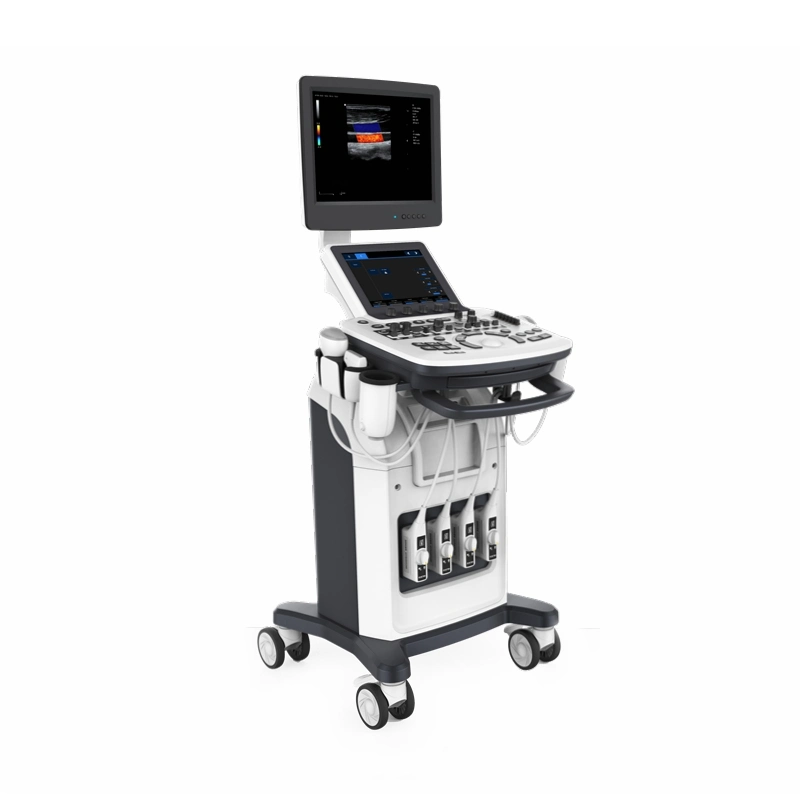 High Quality Color Doppler Ultrasound Diagnosing Equipment