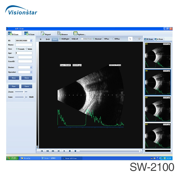 Ophthalmic a/B Scan Sw-2100 Ultrasound Scanner