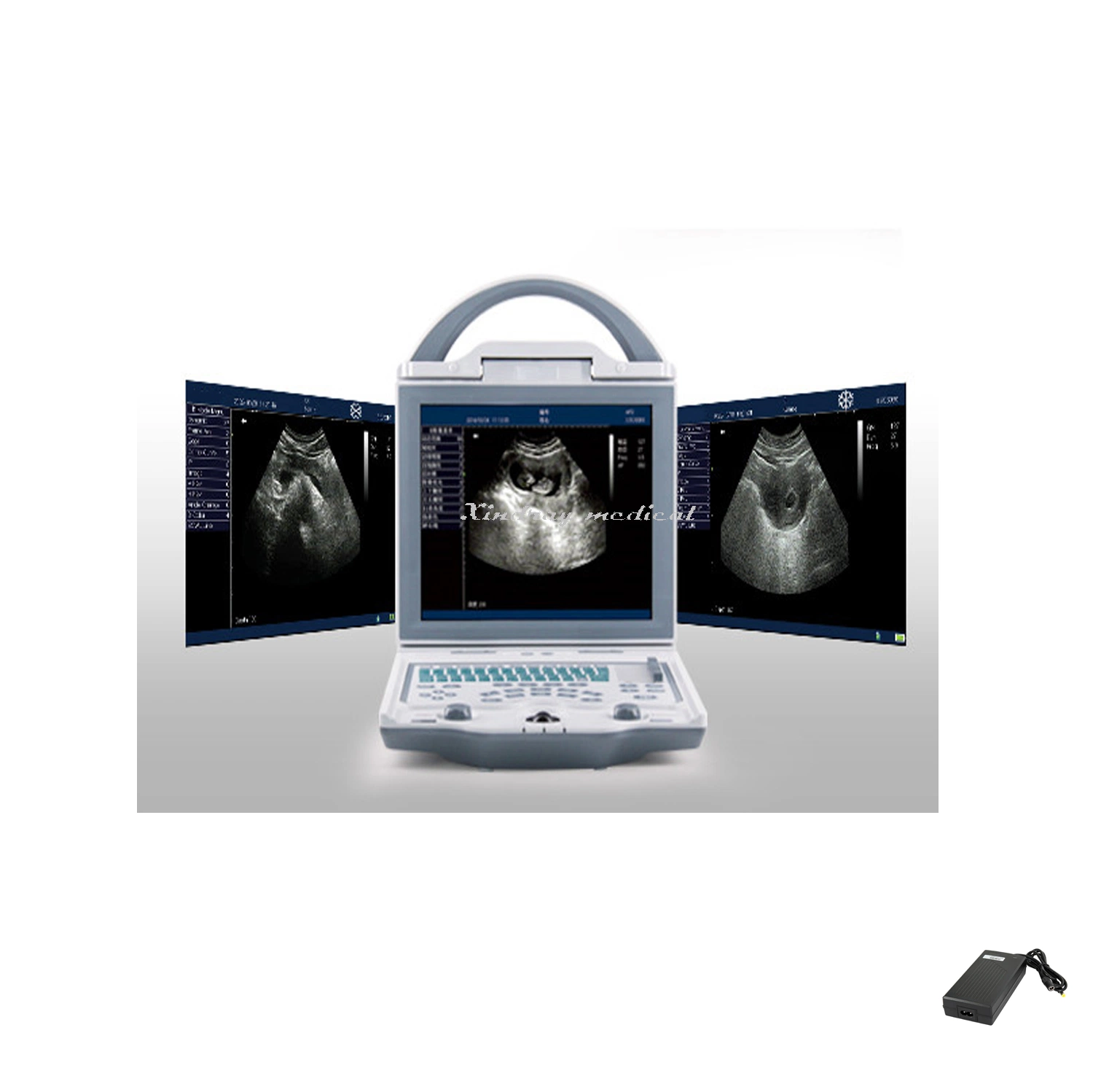 Portable Black and White Ultrasound Buy Ultrasound Scanner