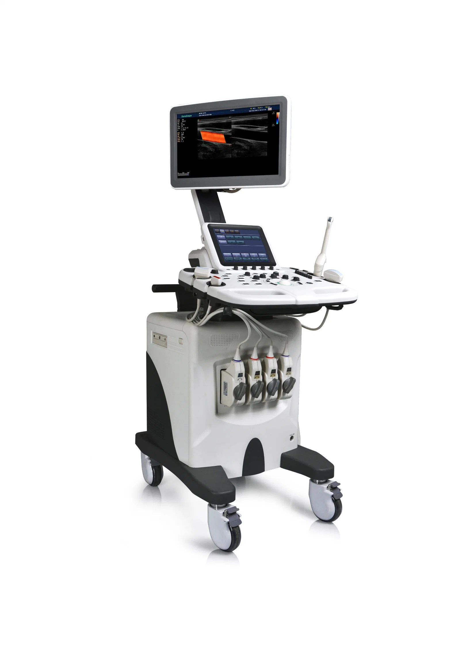 S30 Sonoscape Ultrasound Scanner Sonoscape Echo Machine Sonography Ultrasound Diagnosis Medical Hospital Equipment