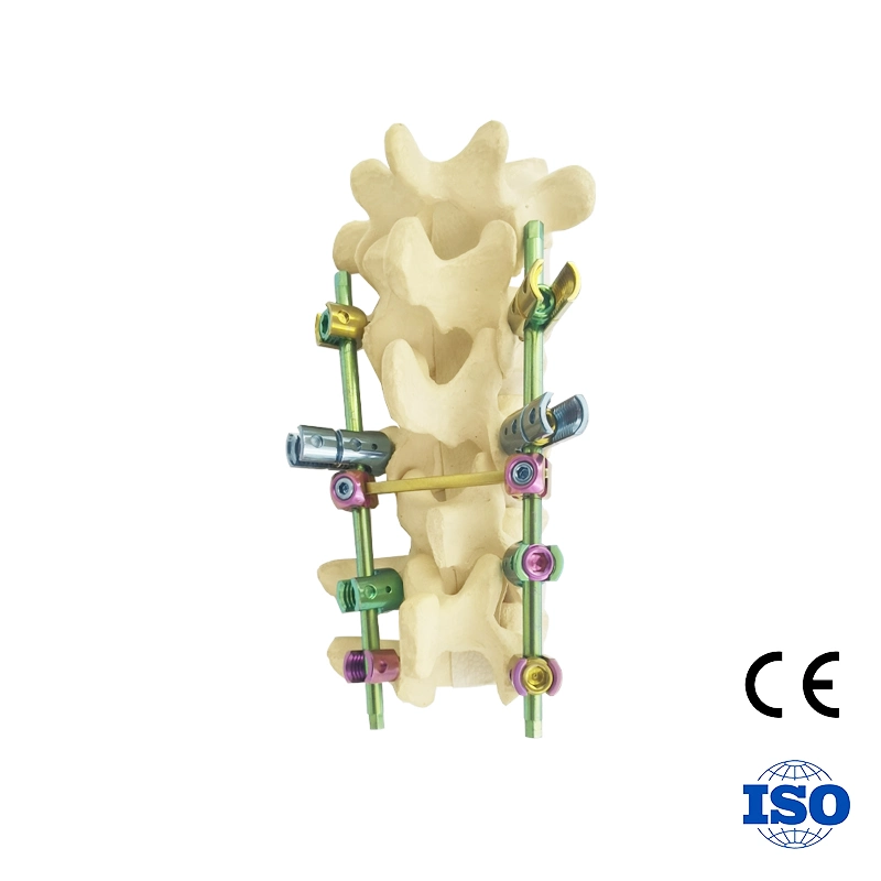 Original Factory 5.5 Breakable Polyaxial Pedical Screw