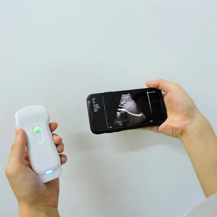 Factory Supply Portable Bluetooth Wireless Color Doppler Portable USB Ultrasound Scanner Probe