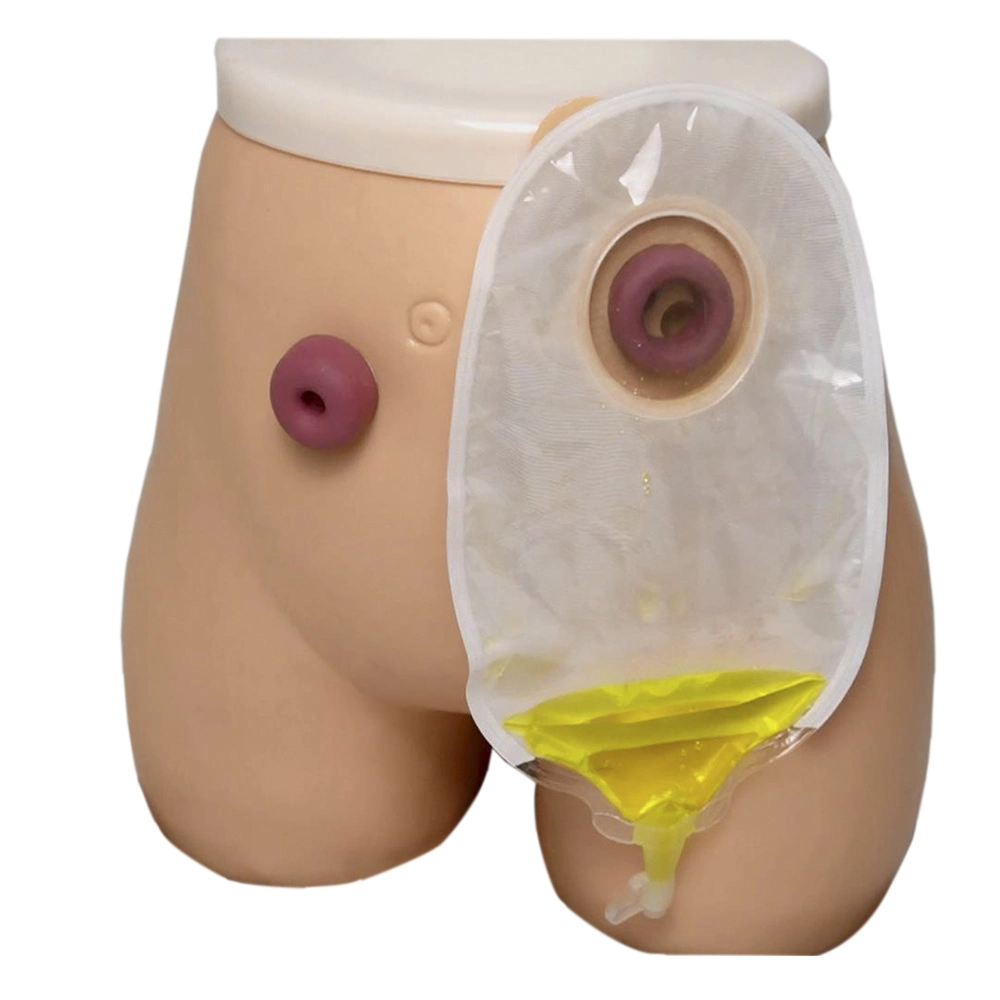 Adhesivos médicos dos piezas Open Size 45mm 50mm 57mm 60mm 70m Urostomía Stama Bag, Ostomía Urina Bag