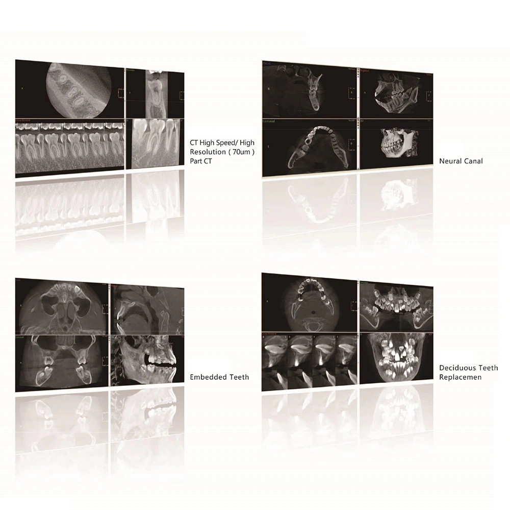 H-X9010d PRO 3D Digital Cbct Dental Panorámica de la máquina de captura de rayos X