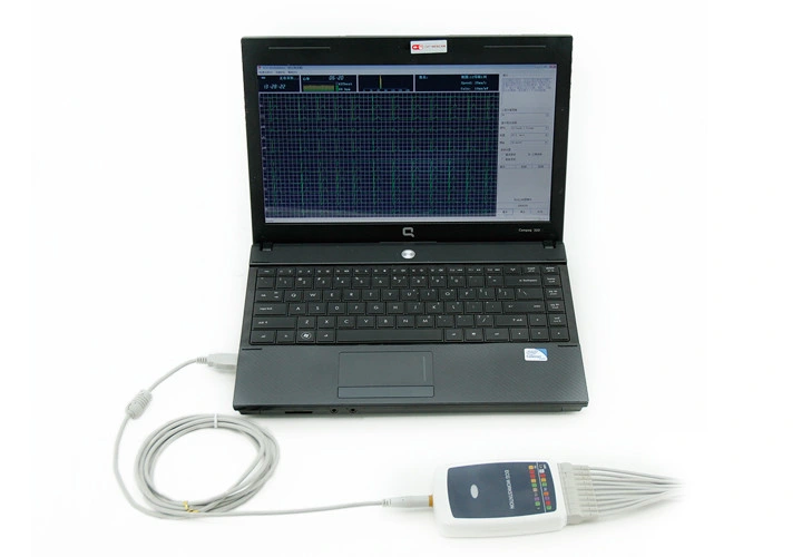 Med-ECG-8000g Laptop ECG Machine, Portable EKG Defibrillator