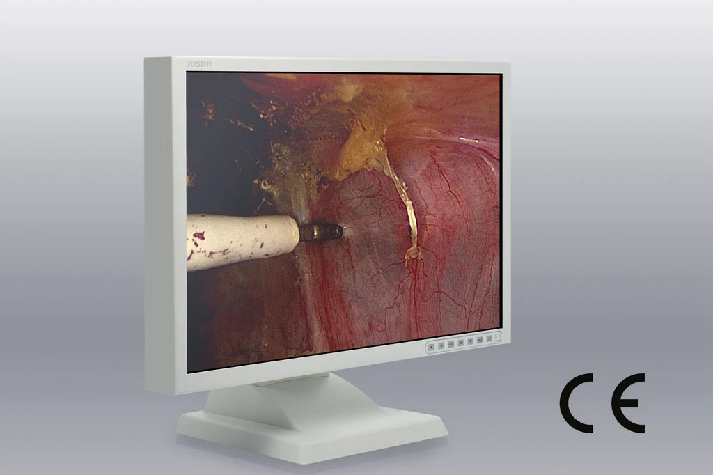 24-Inch 1920X1200 LCD Screen Endoscope Monitor, CE Approved, Endoscope Image System