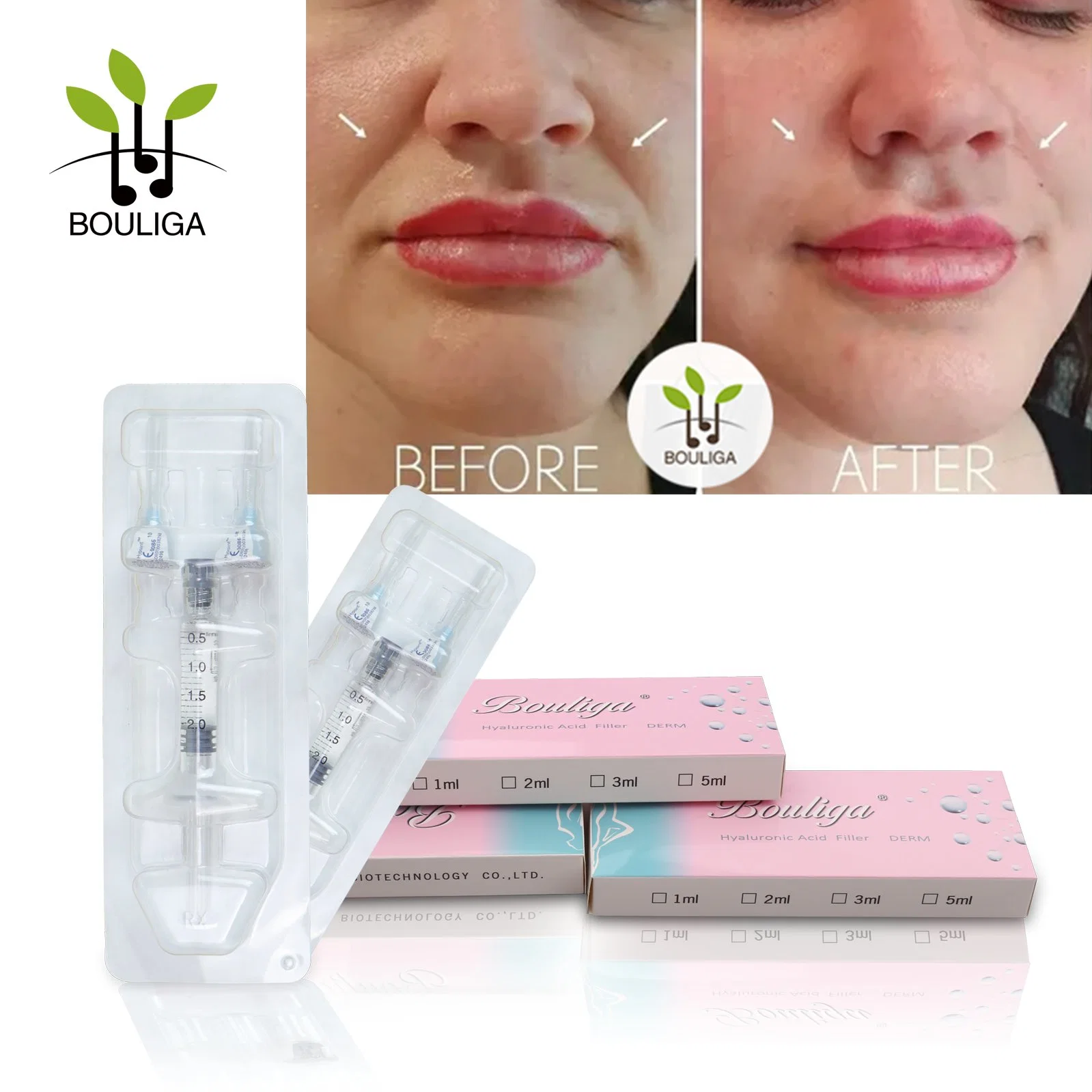 Bouliga Dermal Filler 2ml Cross Linked Ha Filler Beautiful Looking Natural Plump Lips