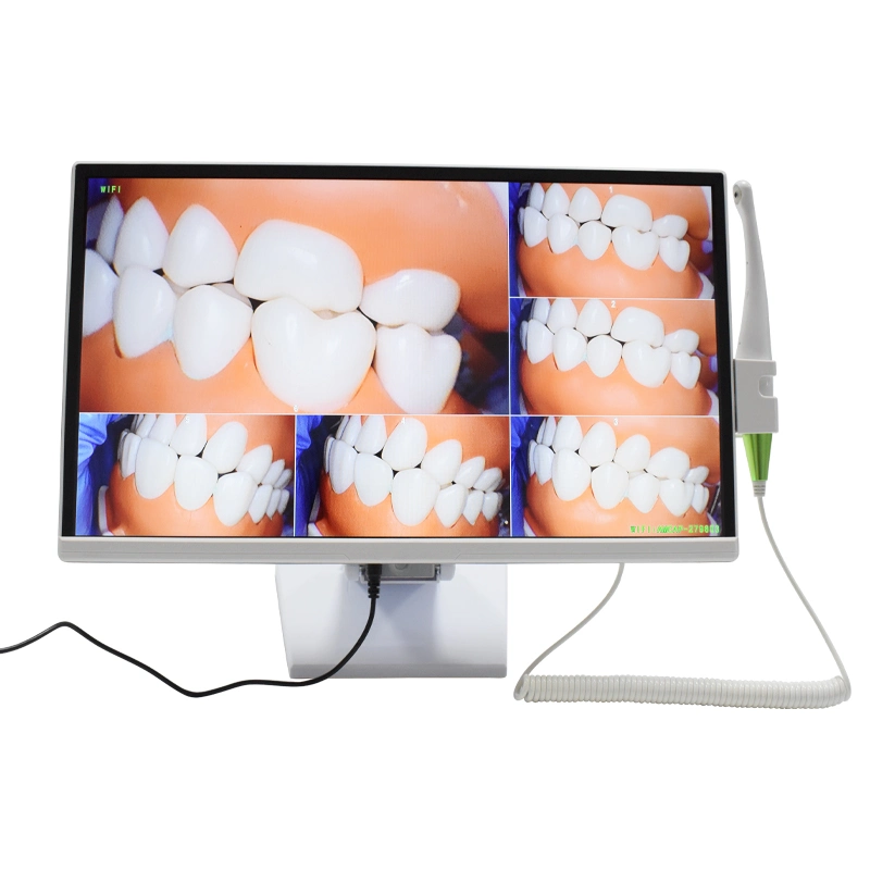 Dental Computer Встроенная эндоскопическая HD камера AI Image System