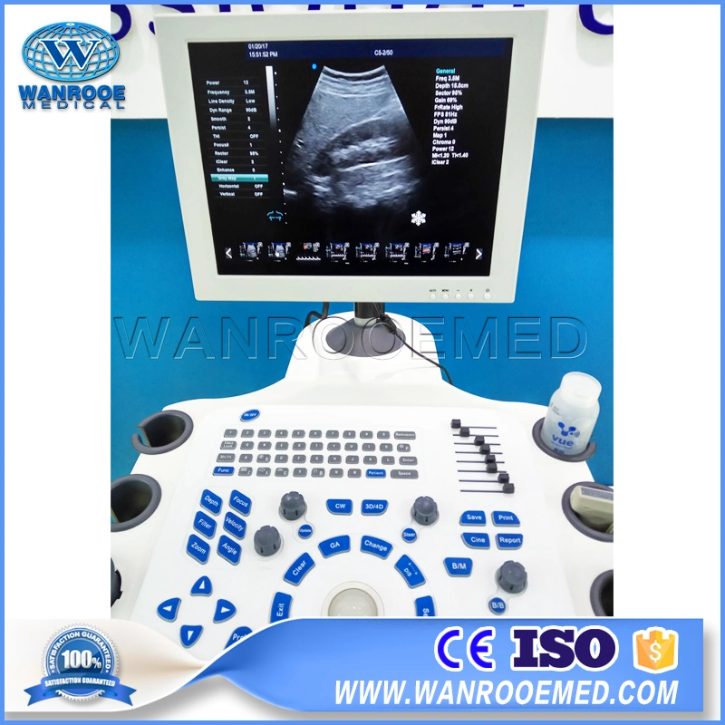 Usc80 Hospital 128 Element Diagnostic Digital Portable 4D Color Doppler Fetal Ultrasound Machine