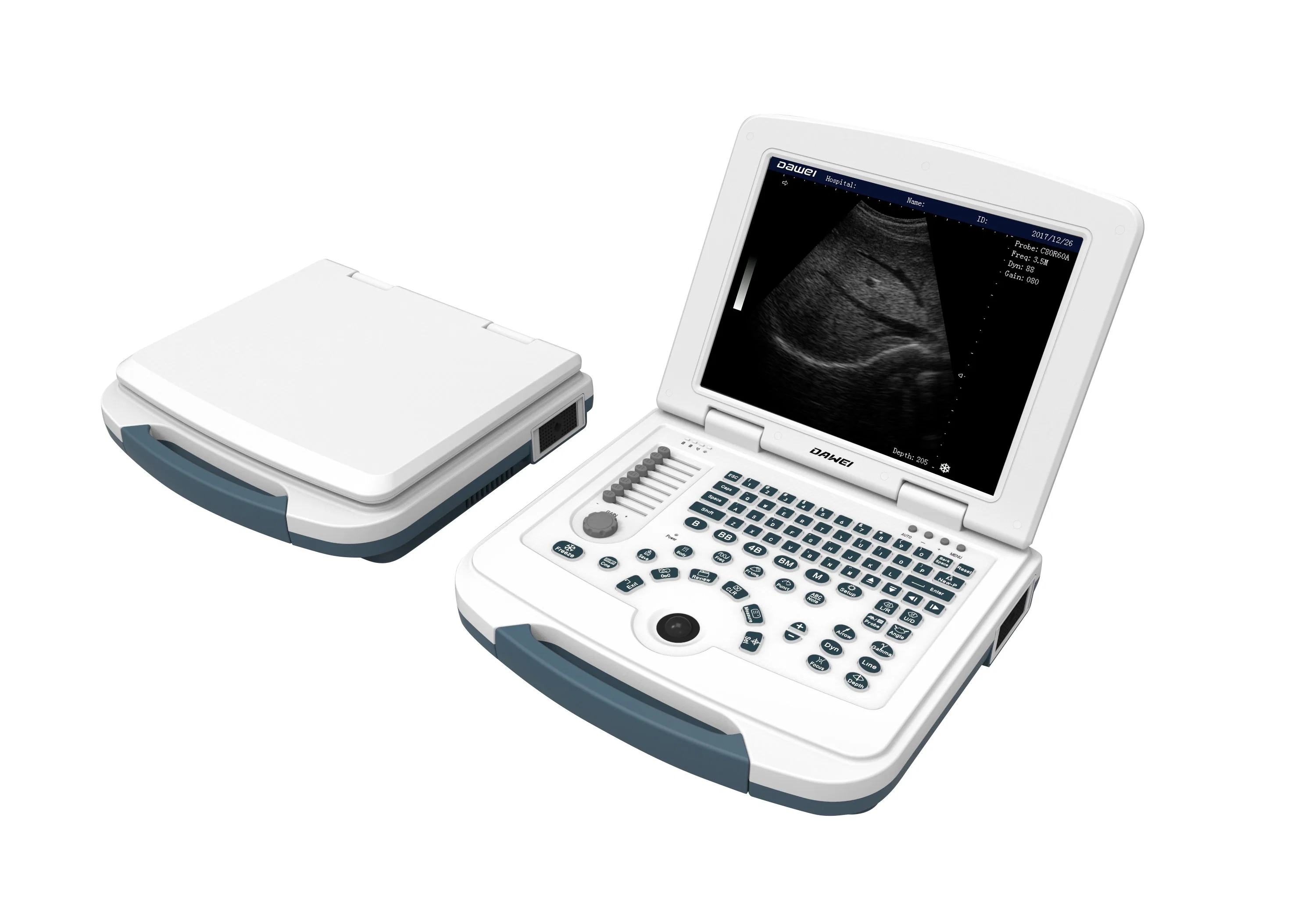 Fast Delivery Portable Digital Black and White B/W Ultrasound Scanner