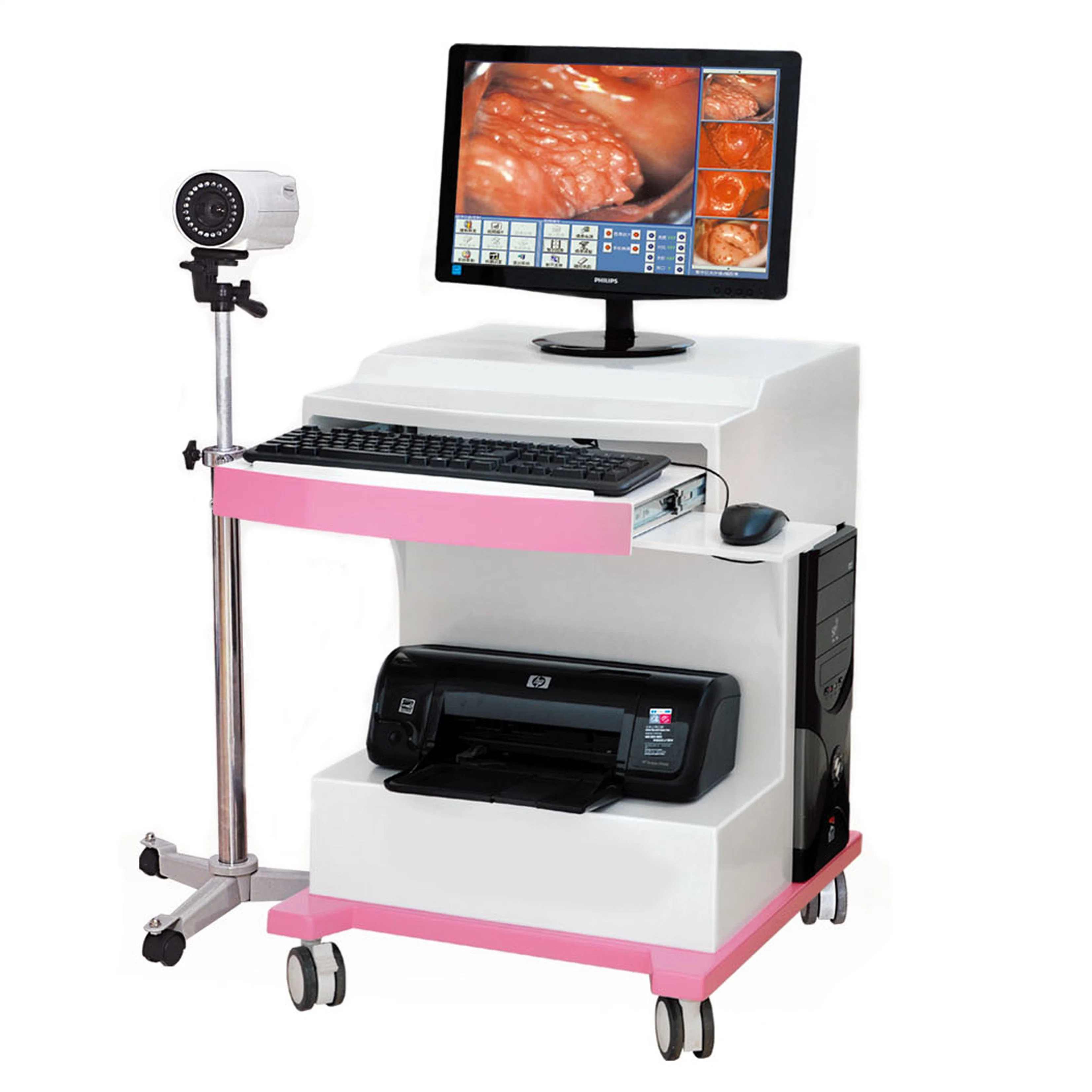 in-G8000c Digital Electronic Vagina Video Colposcope Camera for Gynaecology