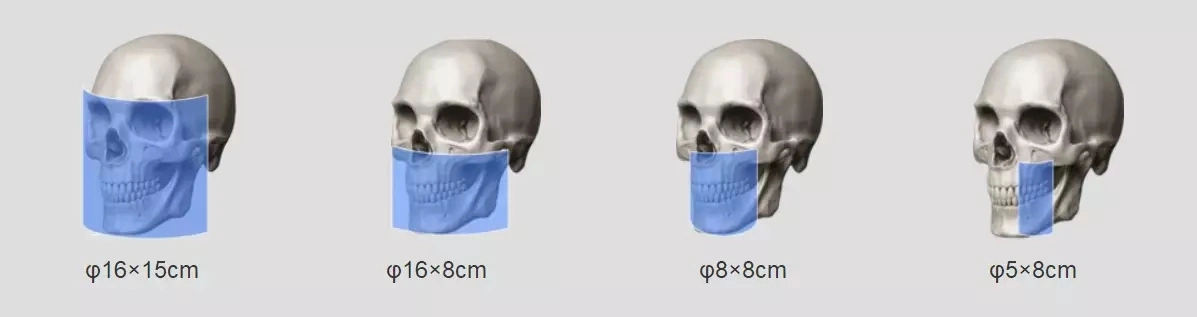 Hires 3D Dental Cbct Professor Xray Scanner 3D Image Examination of Root Cannal 160 150 Fov