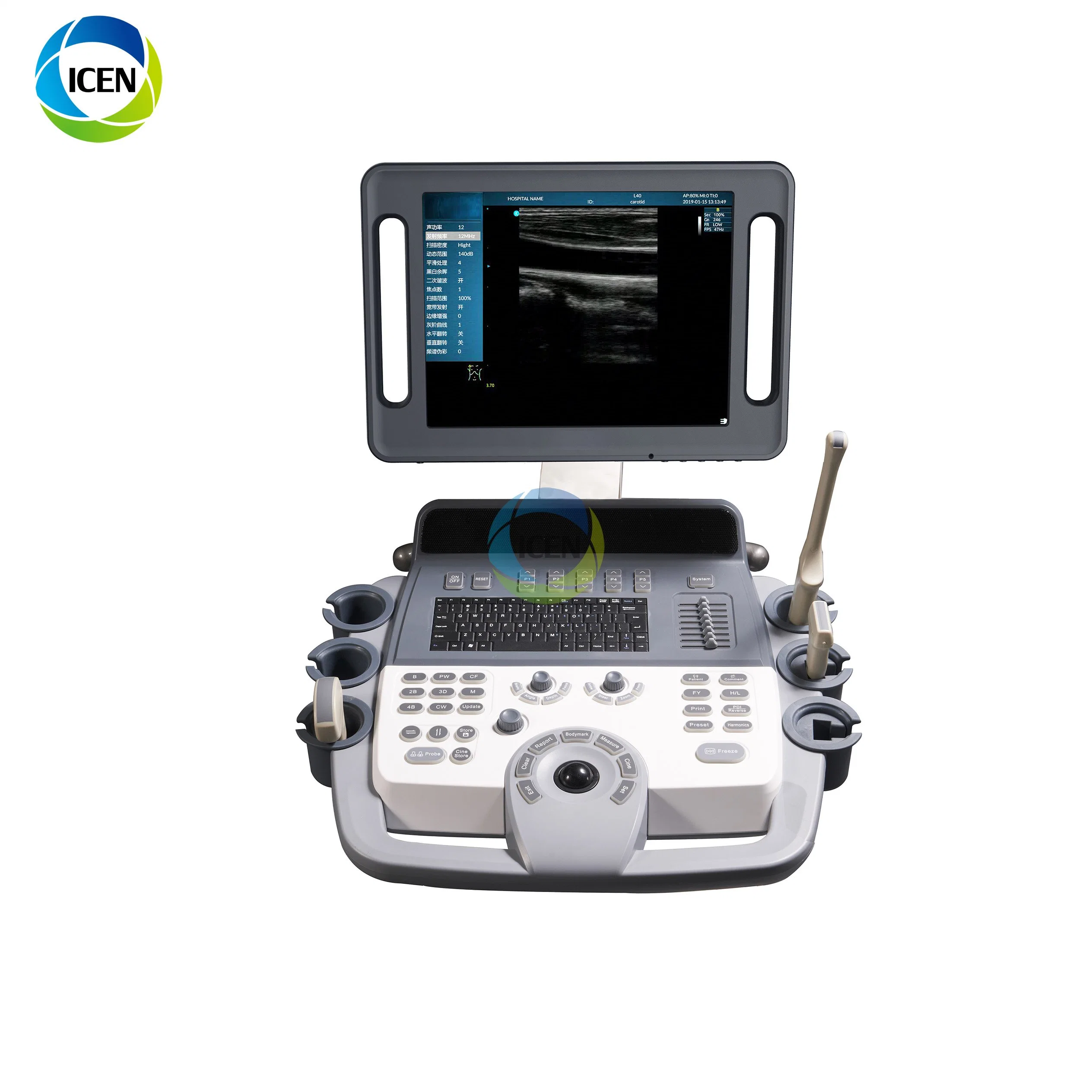 IN-AK12 united ultrasound laptop ultrasound machine color doppler product