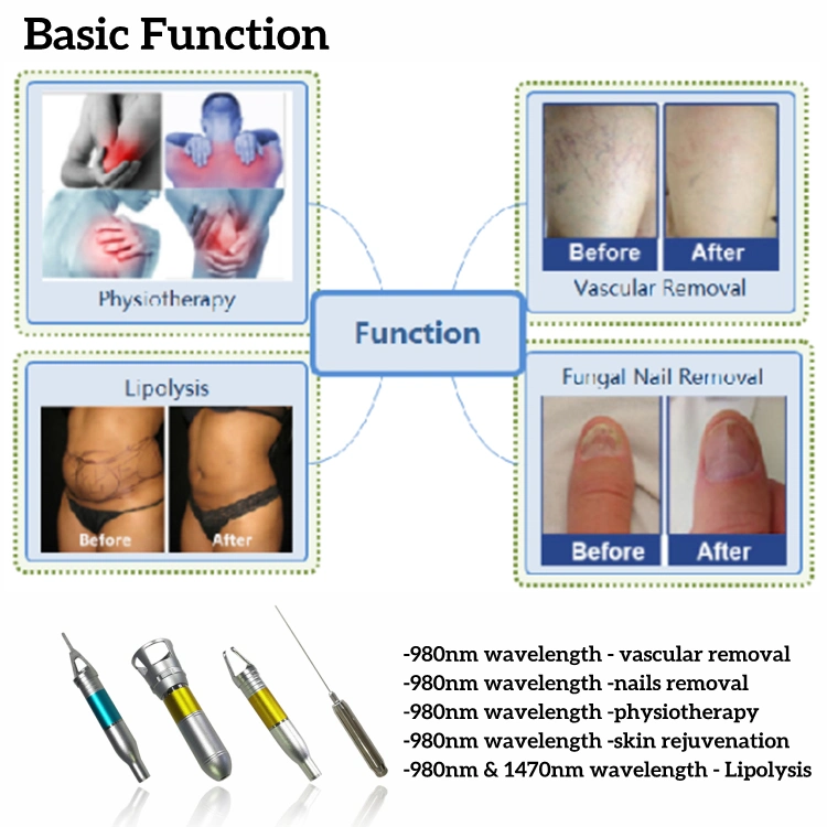 World Lightest Laser Diode Equipment with Special Designed 980 Nm Diode Fiber for Piles, Fistula & 1470 Nm Diode Fiber for Varicose Vein Medical Laser Beauty