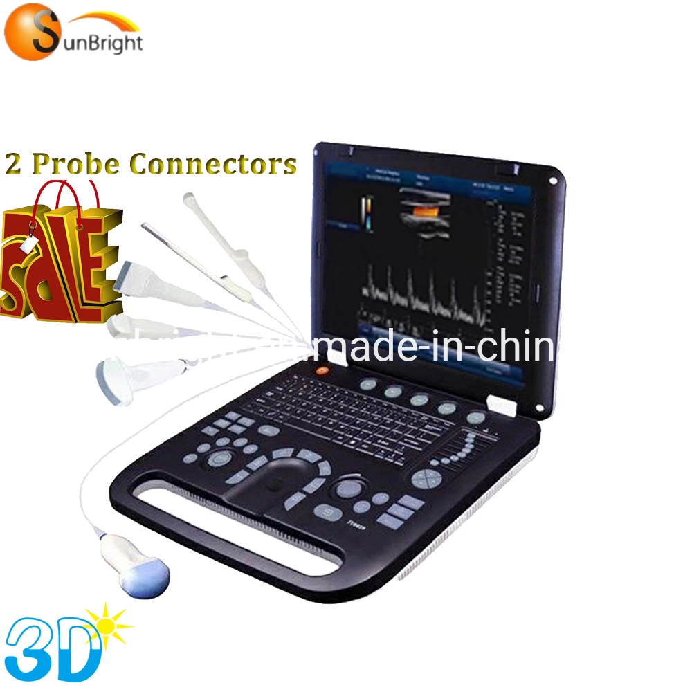 Sun-906A Doppler Ultrasound Laptop 3D 4D Color Doppler Ultrasound