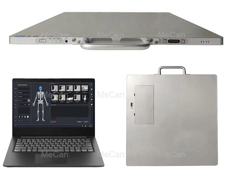 Hospital Digital Xray Machine with Wooden Case Packing