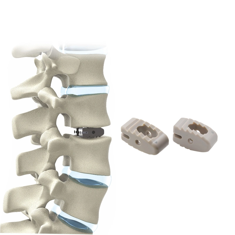 Implants de chirurgie orthopédique de haute qualité Bone Plif lombaire Spine Peek Cage