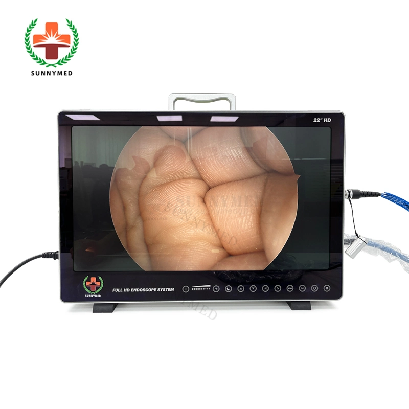 Sy-PS050 Medical Ent/Urology/Laparoscopy/Hysteroscopy Endoscope Integrated 4 in 1 Portable HD Endoscope Camera System