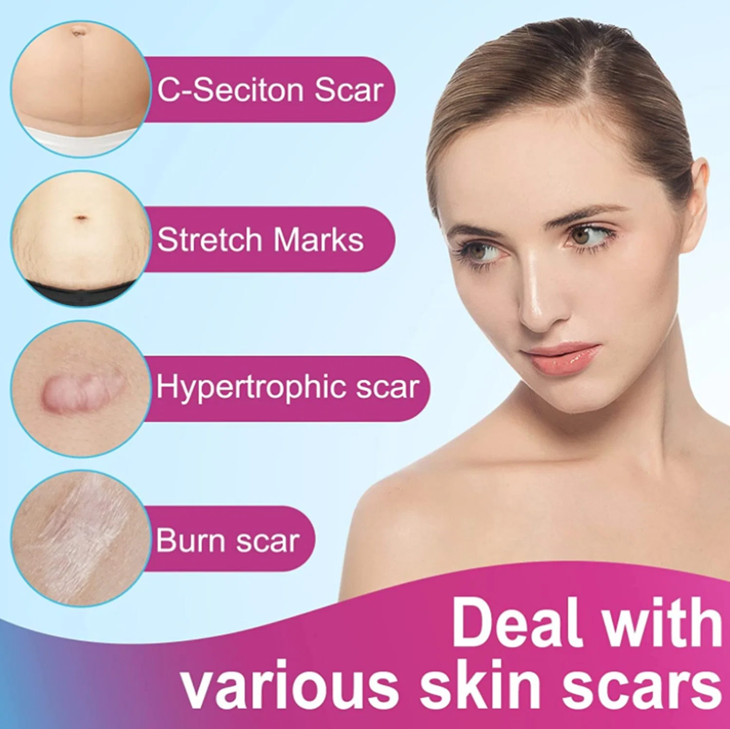 Narbenentfernung, wiederverwendbare wasserdichte professionelle Scar Behandlung Patch für C-Abschnitt, Keloids, Chirurgie