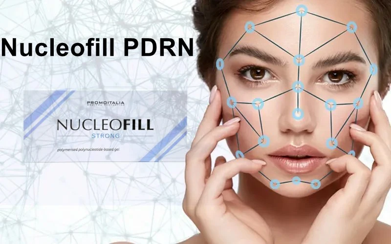 Nucleofill or Profhilo Treatment Nucleofill Strong for Under Eyes Anti Aging Cheek Efekty Zabieg Opinie Nucleofill Soft Eyes Mesotherapy