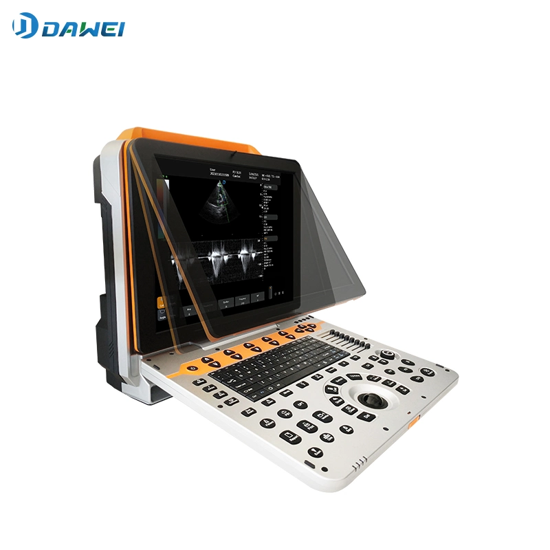 High quality/High cost performance 4D Color Doppler Dwp60 Ultrasound Diagnostic Scanner