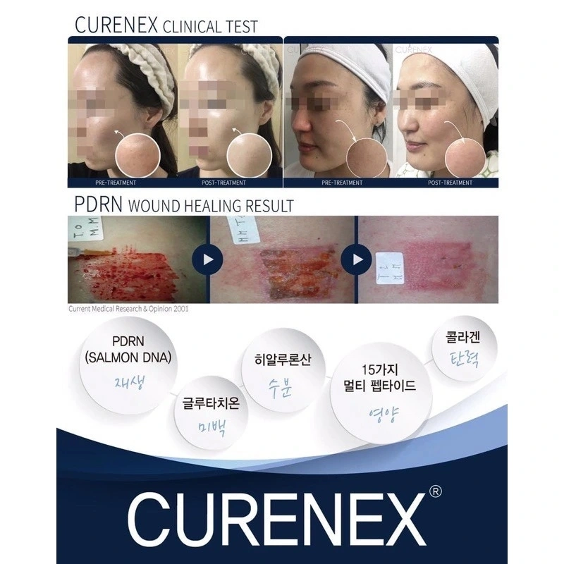 2023 علاج جديد بالمسthern Mestherapy علاج كورنيكس تجديد السلمون الحمض النووي skinrooster Hyaluronic حمض منتج البشرة الجميل تغذية البشرة مرونة البشرة