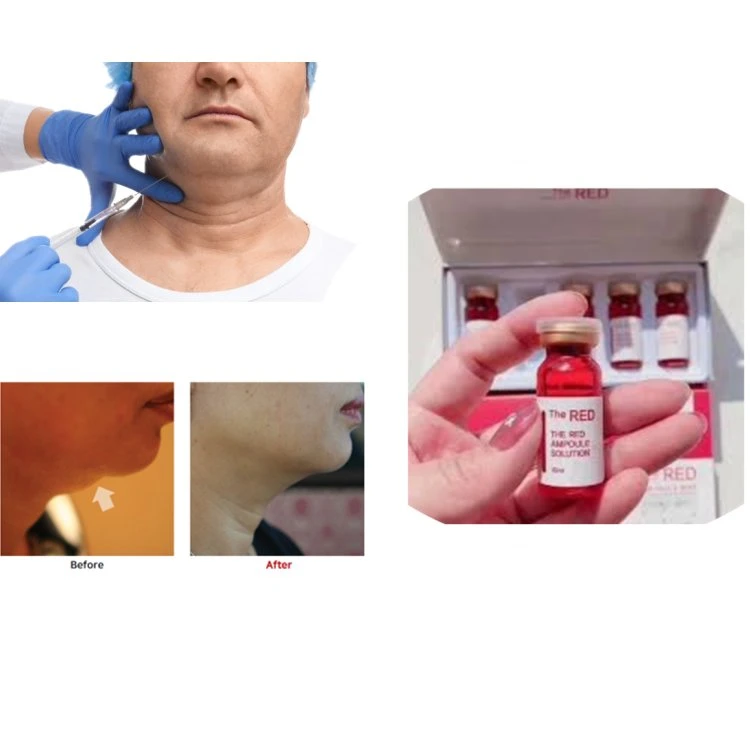 Inyección de la solución lipolitica roja suero lipolitico disolvedor de grasa