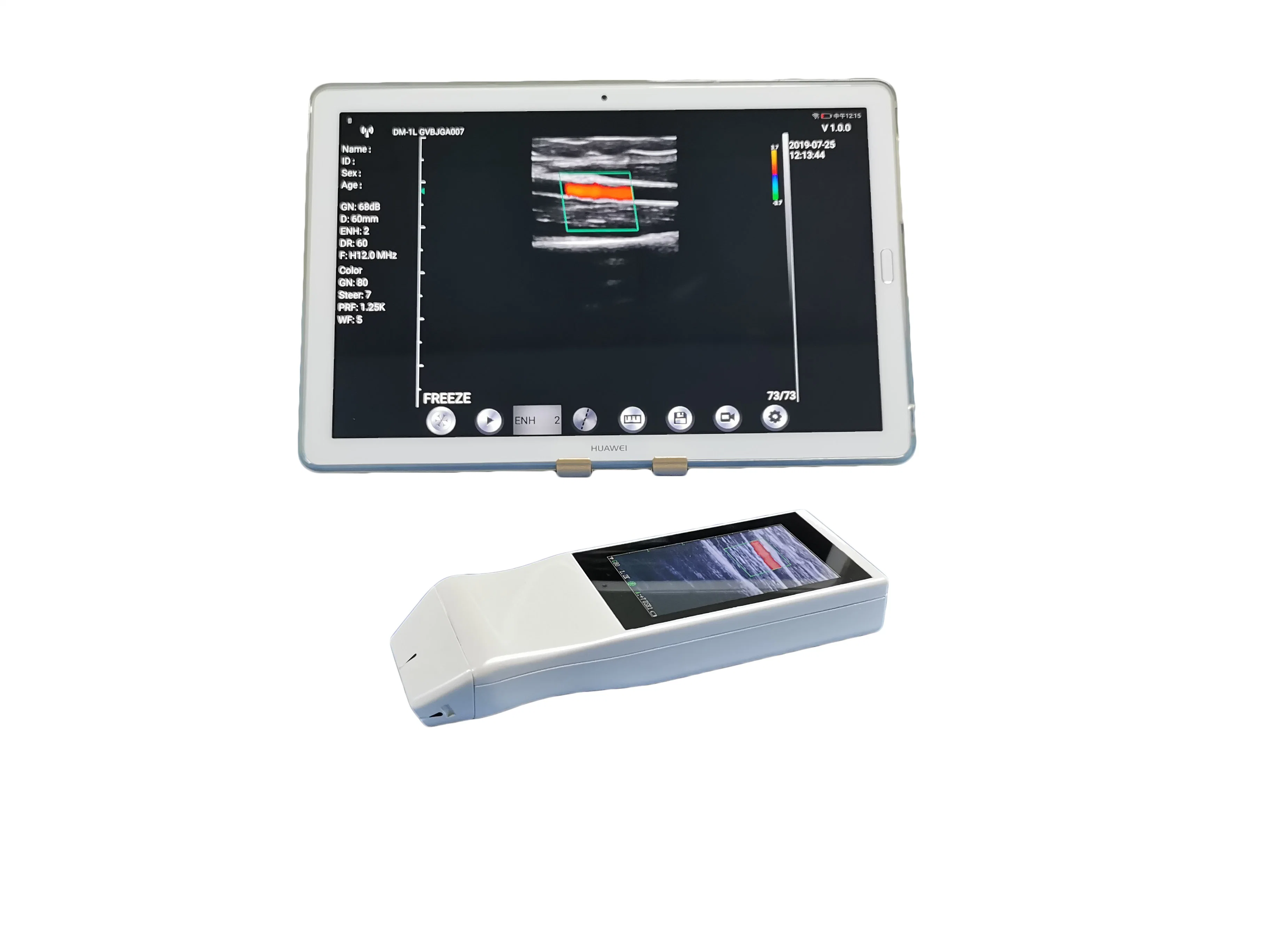 Medical Equipment Ysb-V5p Wireless Color Doppler Probe Ultrasound Medical Equipment