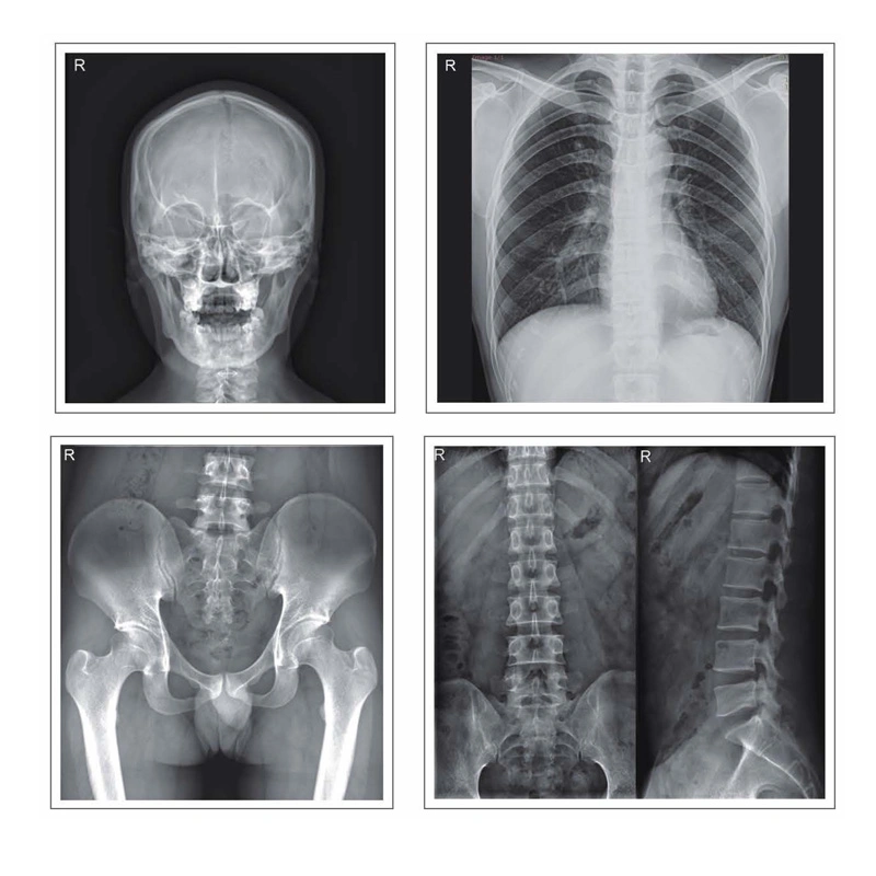 Le Dr numérique X Ray détecteur à panneau plat pour la radiographie numérique 2021