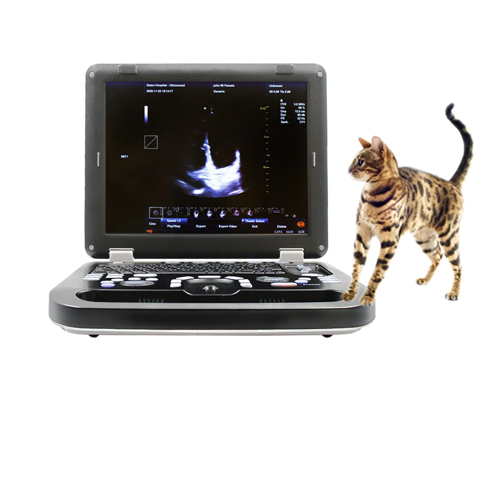 Appareils Doppler fœtal Tele Medicine appareils de santé échographie portable