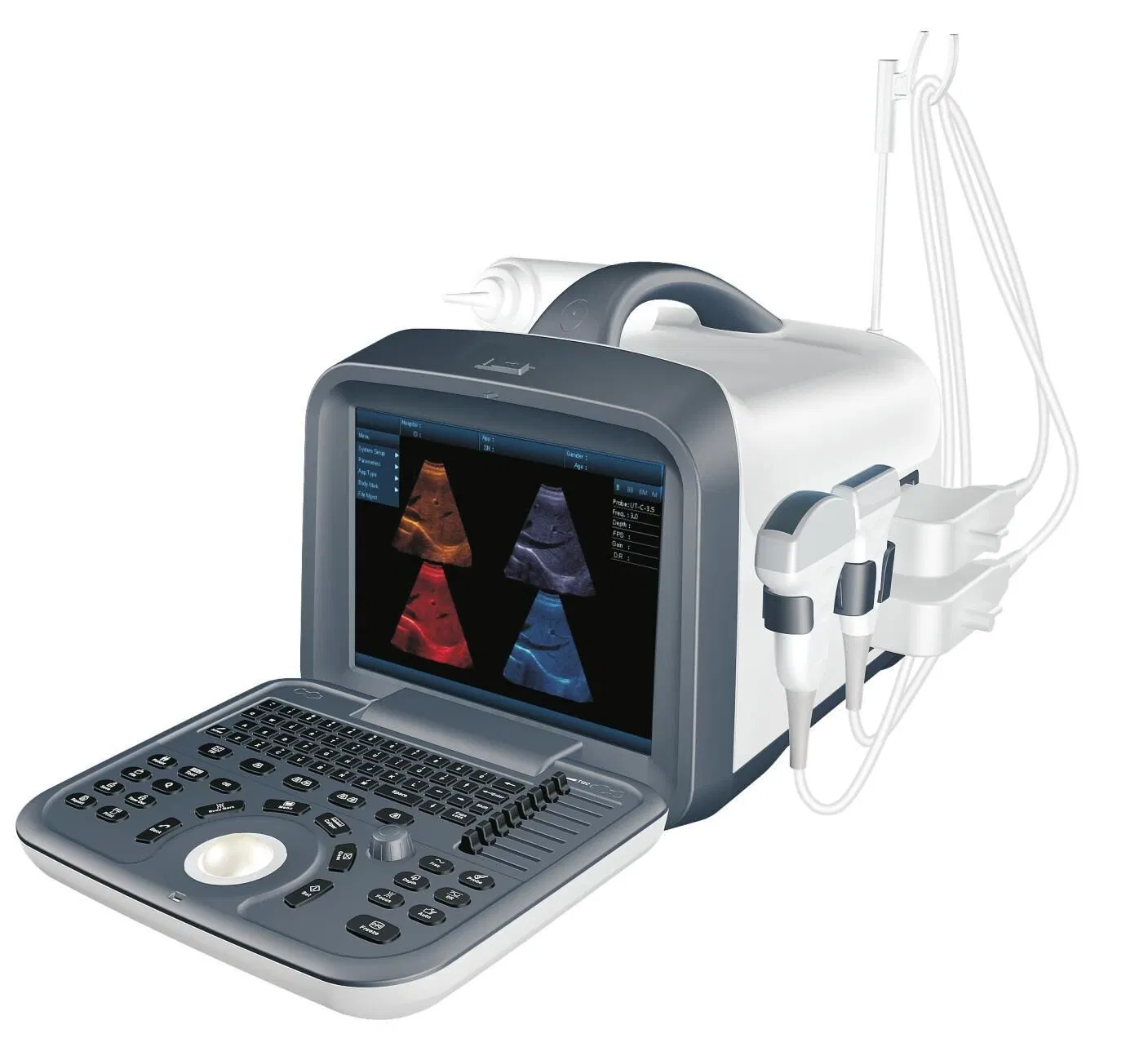 PT6602 Portable Ultrasound Ultrasonic Diagnostic System, All Digital B/W Ultrasound System with High Quality