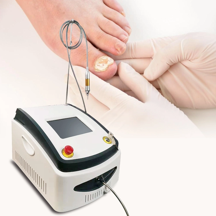 Diodenlaser 980nm für Nagellaser Onychomykose-Therapie Laser-Maschine