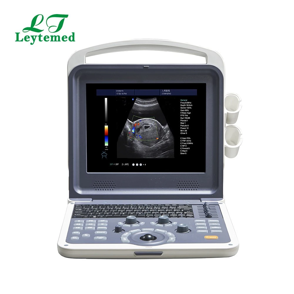 Ltub01V Vet Portable Color Ultrasound Scanner for Hospital