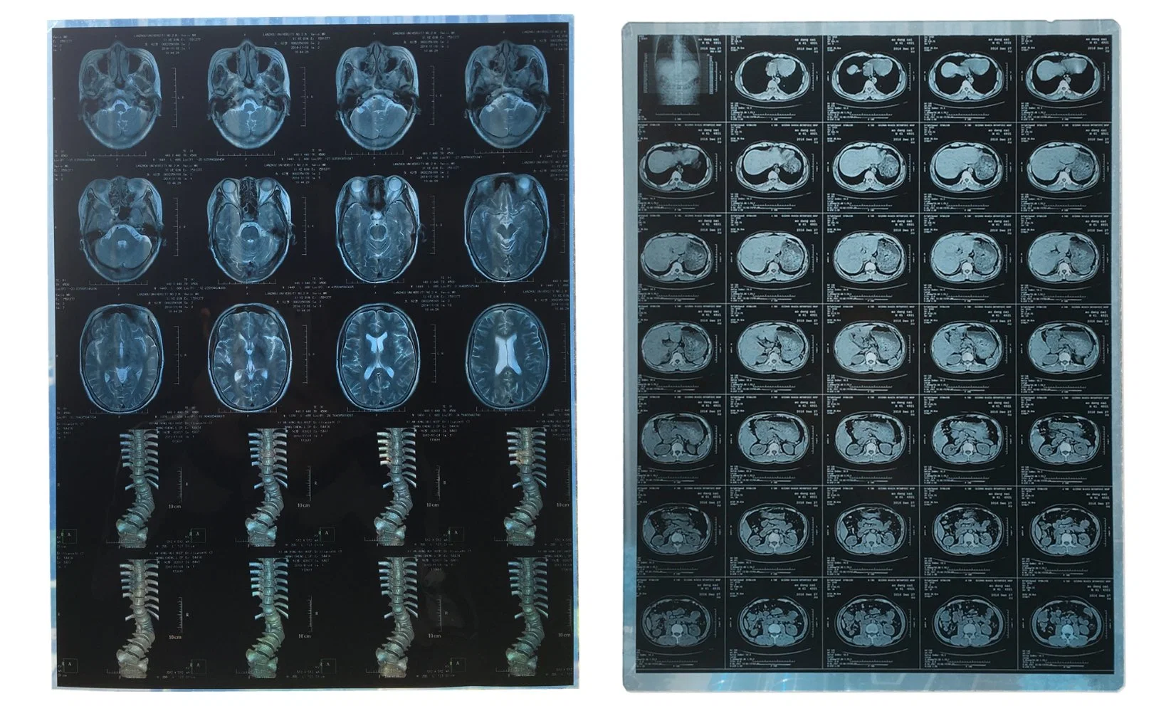 Grossista Lyd Medical X filme radiográfico Dry Térmico para Fuji impressora AGFA