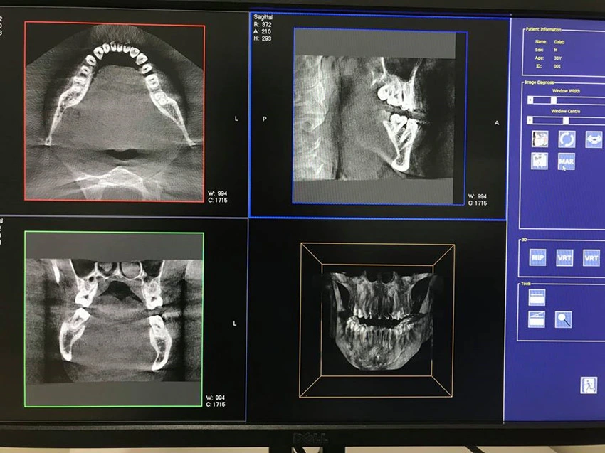 Imágenes panorámicas cefalométrico dental de rayos X CT máquina